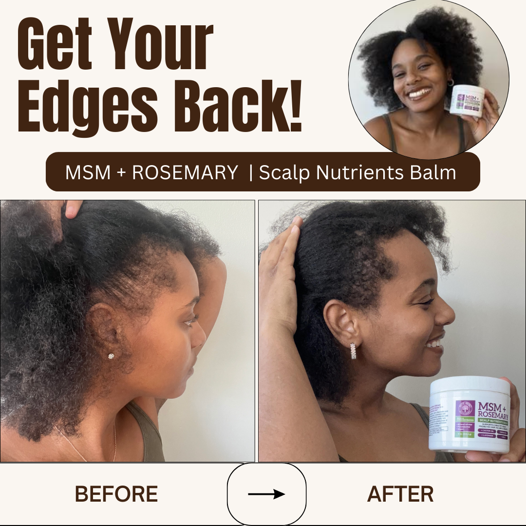 MSM + ROSEMARY | Scalp Nutrients Balm - Qhemet Biologics