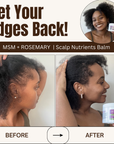MSM + ROSEMARY | Scalp Nutrients Balm - Qhemet Biologics