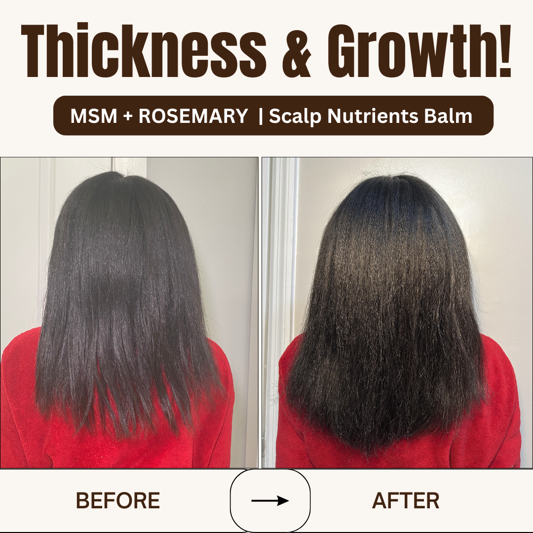 MSM + ROSEMARY | Scalp Nutrients Balm - Qhemet Biologics