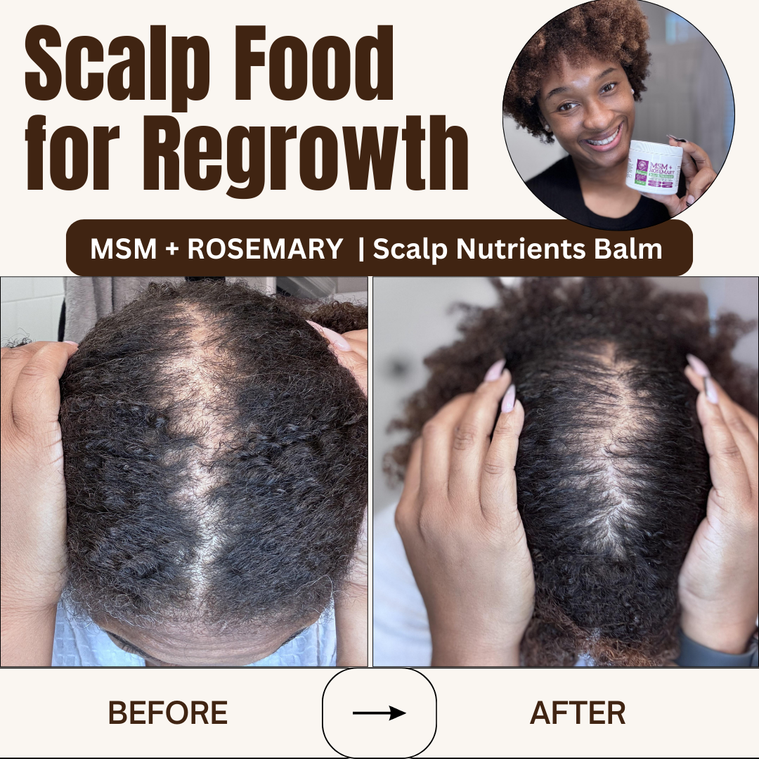 MSM + ROSEMARY | Scalp Nutrients Balm - Qhemet Biologics