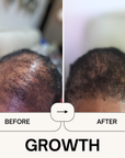 Power Your Growth Bundle - Qhemet Biologics
