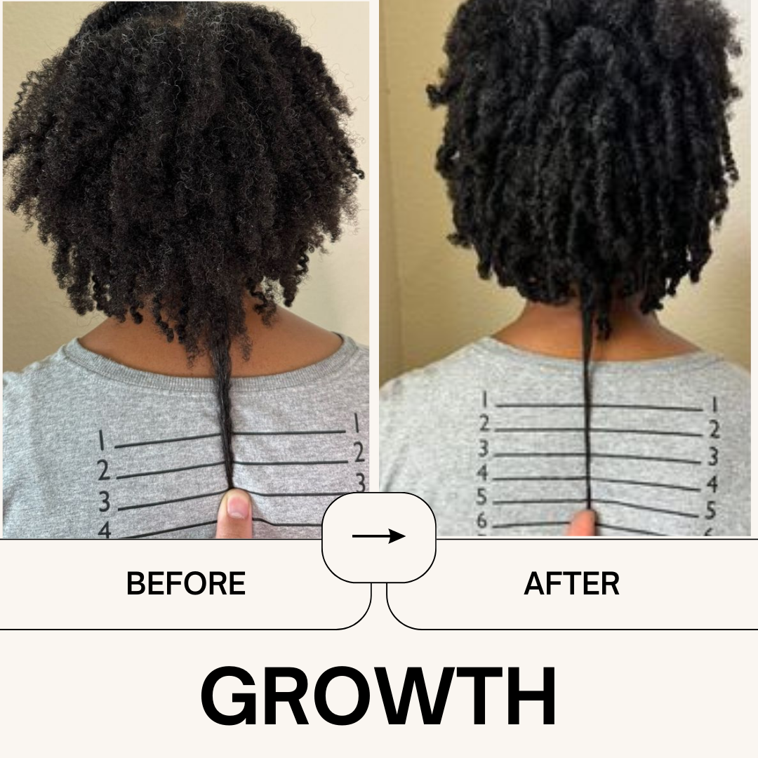 Power Your Growth Bundle - Qhemet Biologics