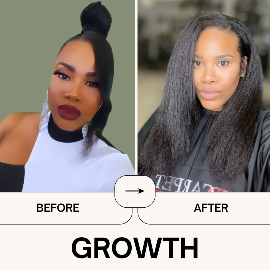 Power Your Growth Bundle - Qhemet Biologics