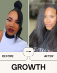 Power Your Growth Bundle - Qhemet Biologics