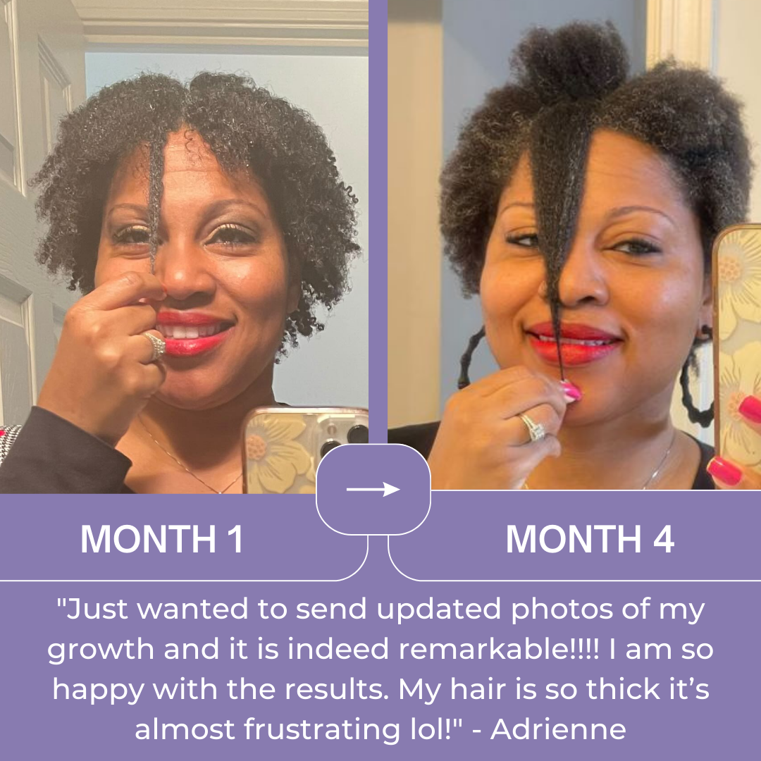 MSM + BIOTIN | Hair Nutrients Blend - Qhemet Biologics