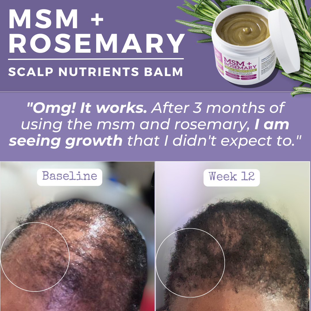 MSM + ROSEMARY | Scalp Nutrients Balm - Qhemet Biologics