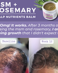 MSM + ROSEMARY | Scalp Nutrients Balm - Qhemet Biologics
