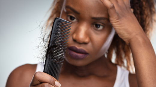 TOP CAUSES OF HAIR LOSS & SHEDDING IN WOMEN