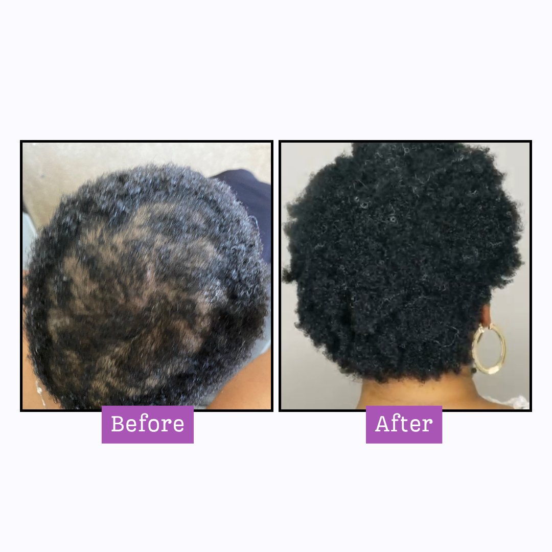 Castor Oil Collection For Moisture &amp; Growth