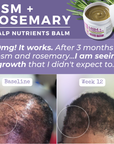 MSM + ROSEMARY | Scalp Nutrients Balm